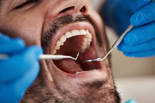 Best Tooth Infection Emergency Dentist  in Soh Willard, UT